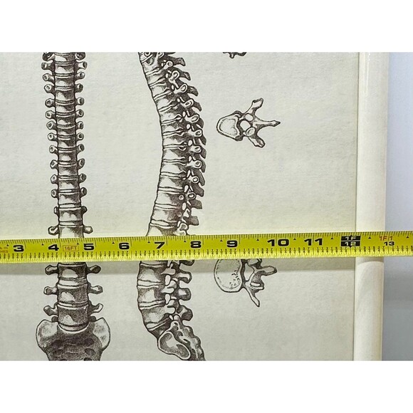 Skeleton Skeletal Spine Framed Artwork Picture - Picture 3 of 4